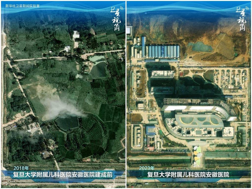 2023年與2018年相比，復(fù)旦大學(xué)附屬兒科醫(yī)院安徽醫(yī)院從一片荒地到建成投用。該項(xiàng)目是安徽省在長三角一體化高質(zhì)量發(fā)展衛(wèi)生健康領(lǐng)域的重大項(xiàng)目，也是安徽首批落地的國家區(qū)域醫(yī)療中心。